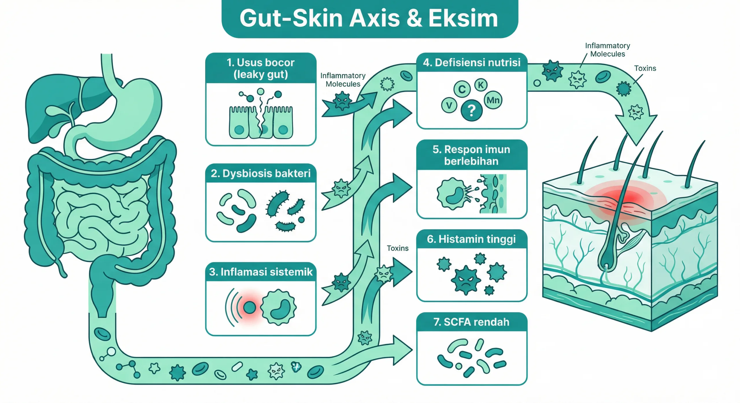 Infografik eksim kulit dan hubungan bakteri usus