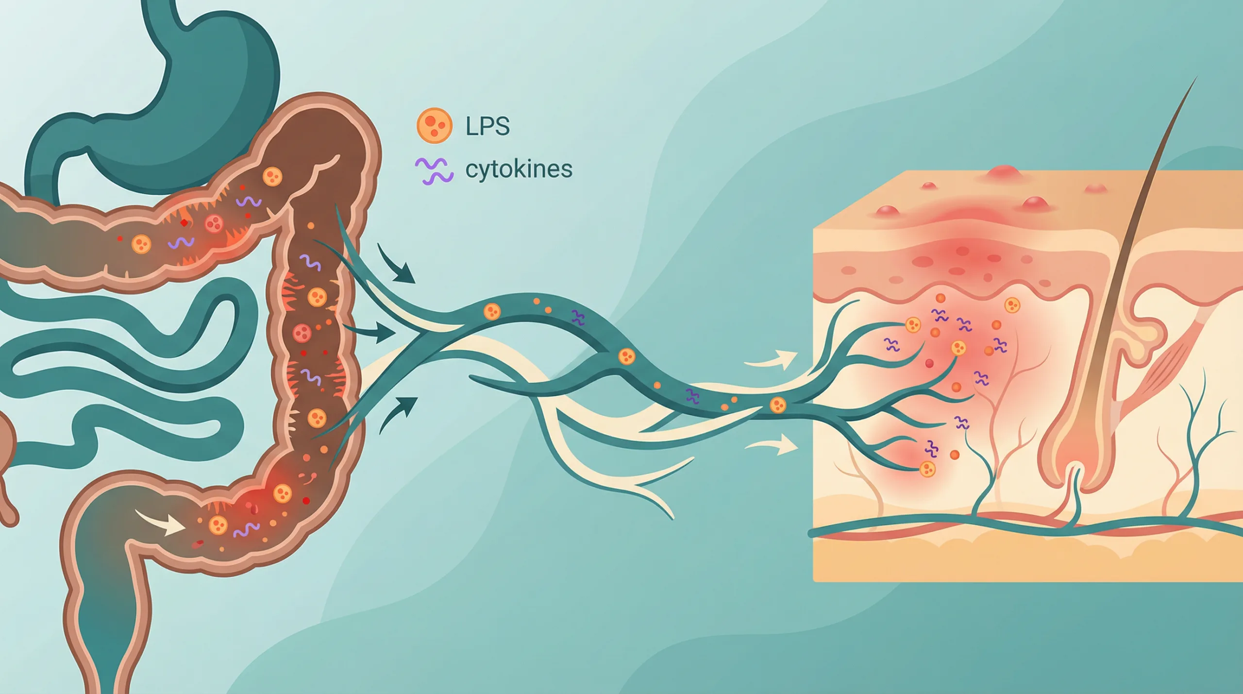 Hubungan eksim kulit dengan mikrobiom usus