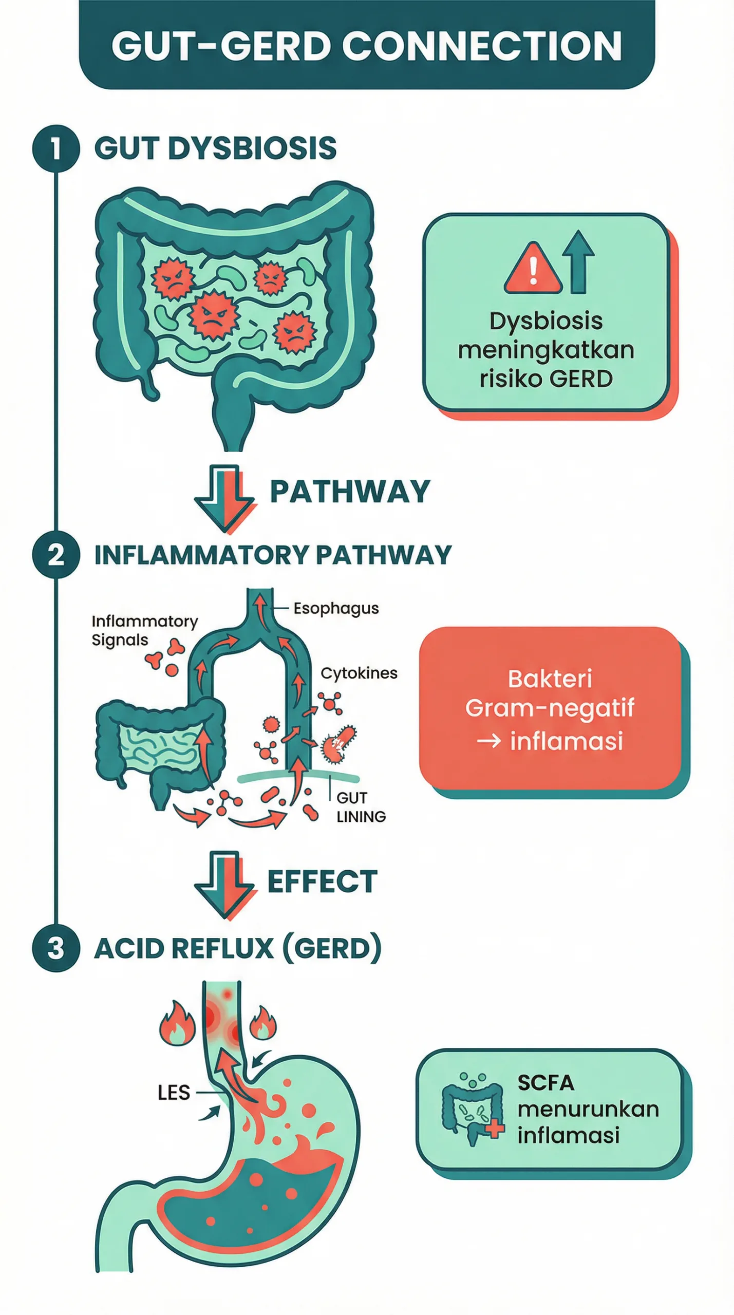 Infografik penyebab asam lambung naik dan hubungan bakteri usus GERD